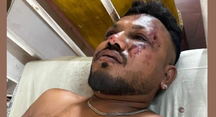 अहमदाबाद विमान हादसा जिंदा बचा एक यात्री,चमत्कार से कम नहीं